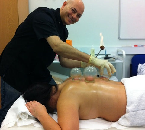 physical therapist performing dry cupping session