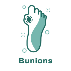 Hallux Valgus and Bunions