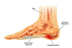 Foot care and plantar fasciitis foot pain relief