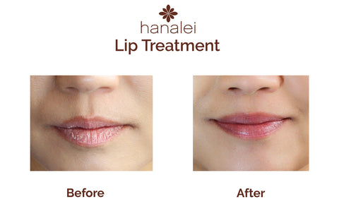 Lip Scrub Benefits