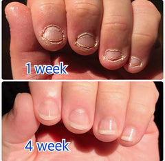 A good resolution ! — Stop biting your nails in 33 days. — MAVALA  INTERNATIONAL