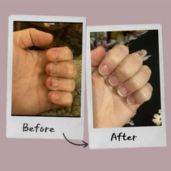 Before and after nails_1