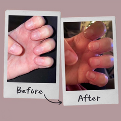 Before and after nails_2