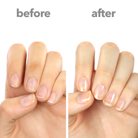 HOW TO GET LONG, STRONG AND HEALTHY NAILS – selfcarehelp