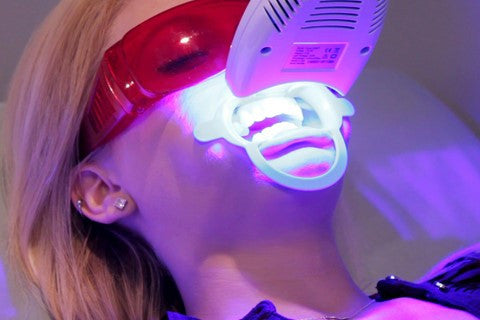 How much does a dentist teeth whitening cost