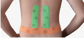 kintape technique for lower back pain