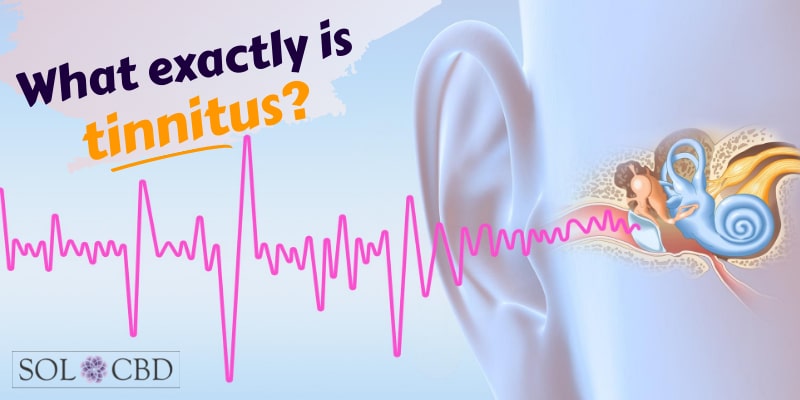 What exactly is tinnitus? And does CBD help?
