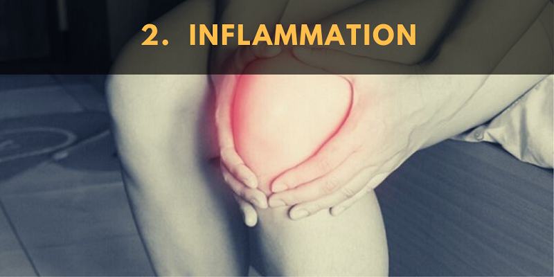 Another popular use for CBD is for inflammatory conditions. 