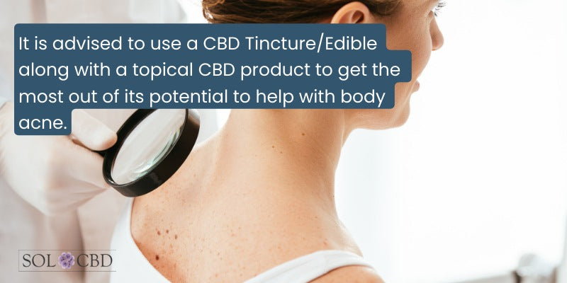 It is advised to use a CBD Tincture/Edible along with a topical CBD product to get a holistic solution.
