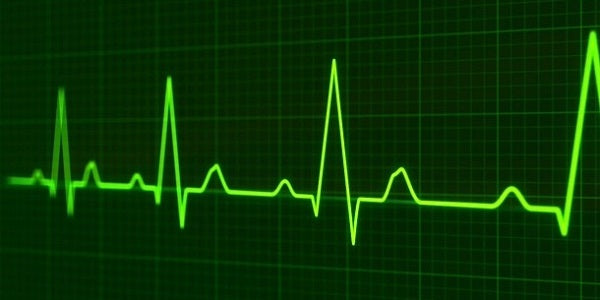 CBD and Heart Arrhythmia