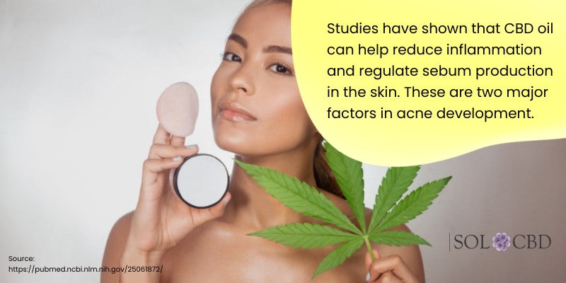 CBD oil can help reduce inflammation and regulate sebum production in the skin. These are two major factors in acne development.