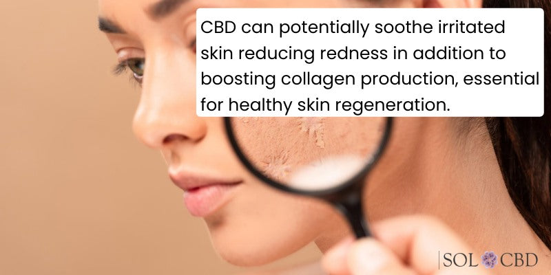 CBD contains anti-inflammatory properties that can help soothe irritated skin and reduce redness. This, in turn, can make scars appear less noticeable.