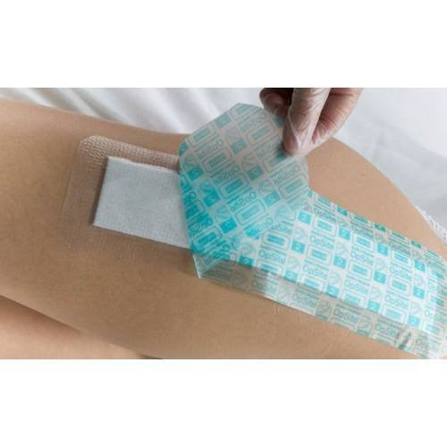 Transparent Film Wound Care Dressings: Clear Semipermeable Dressings ...