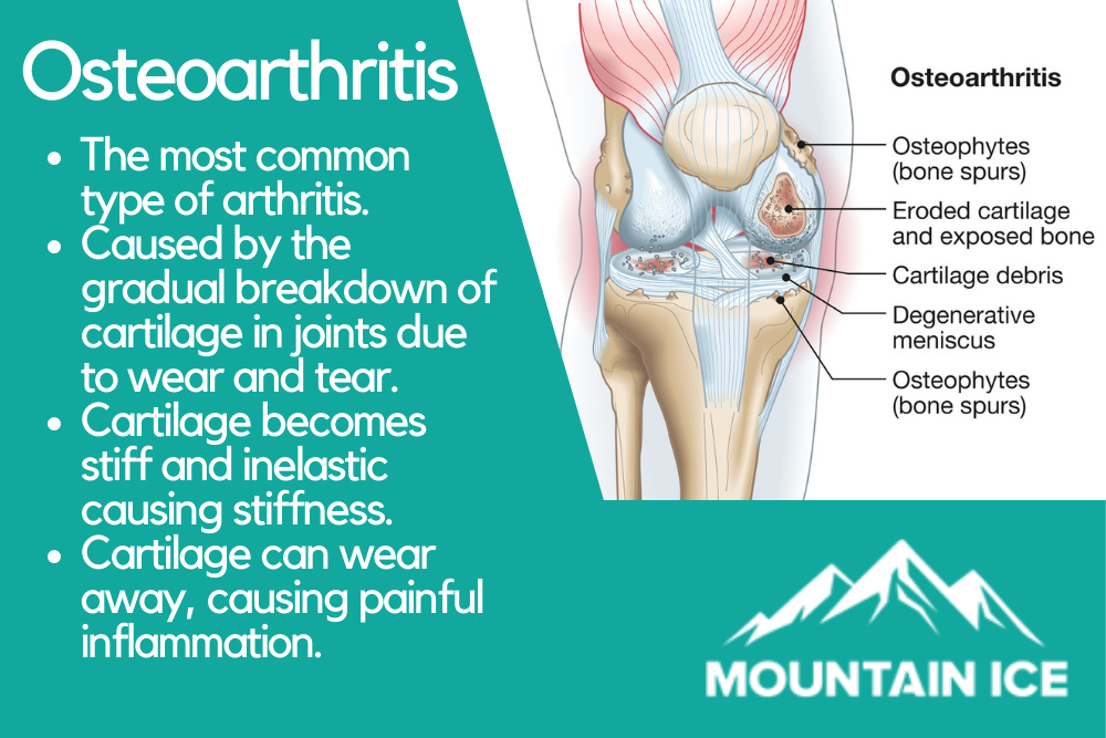 Mountain Ice for Osteoarthritis