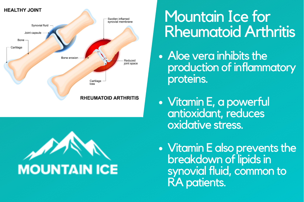 Mountain Ice for Rheumatoid Arthritis