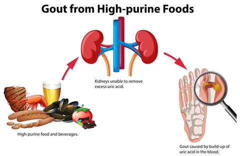 Causes of Gout