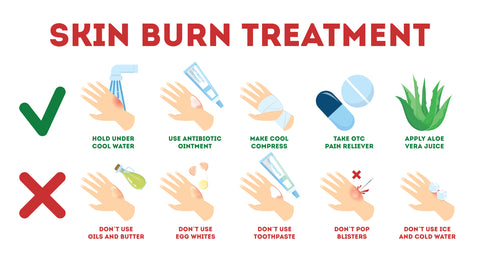 Treating Burns and Burned Skin