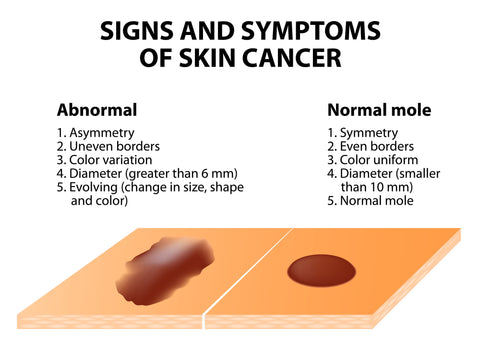 Skin Cancer Detection