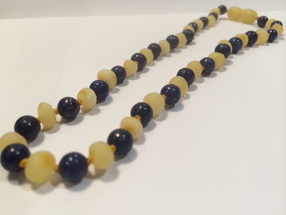 Amber Necklace for Pain