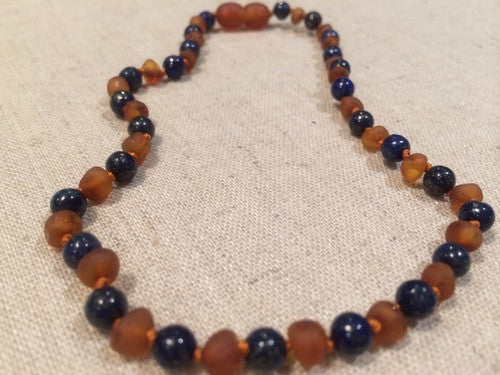 Baltic Essentials Amber Necklaces is a Natural Alternative to Treat Pain