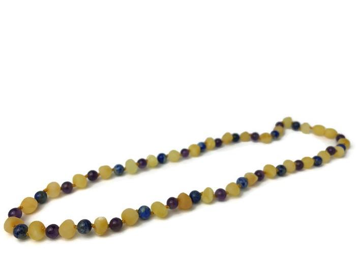 amber beads for anxiety