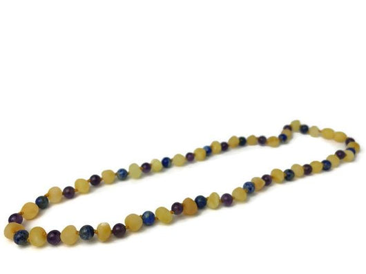 baltic amber necklace for anxiety