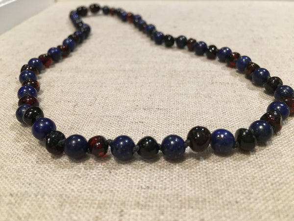 Baltic Amber Necklace - Adult Raw Milk Blue Lapis Pink 18 In Baltic Amber Necklace Sadness Anxiety