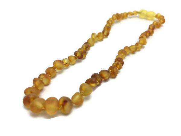 honey amber necklace