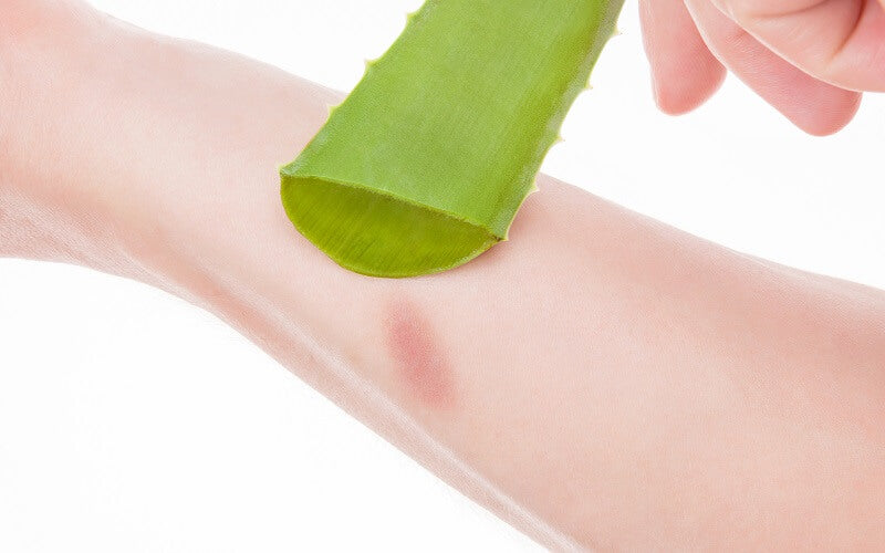 How To Use Aloe Vera For Burns Seven Minerals