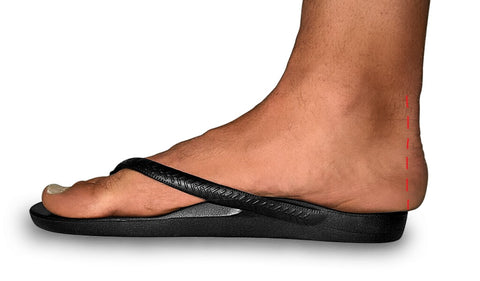 Archies Arch Support Thongs Flip Flops - example of unacceptable overhang