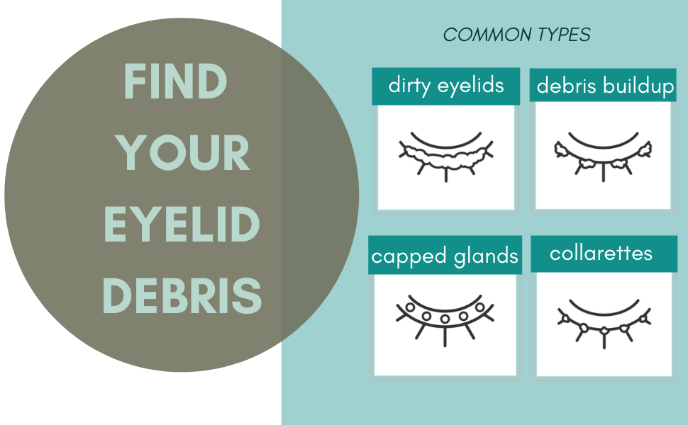 Here we will talk about eyelid debris and the tools that bring the most success. Most of the time, my patients have no clue where to start. 