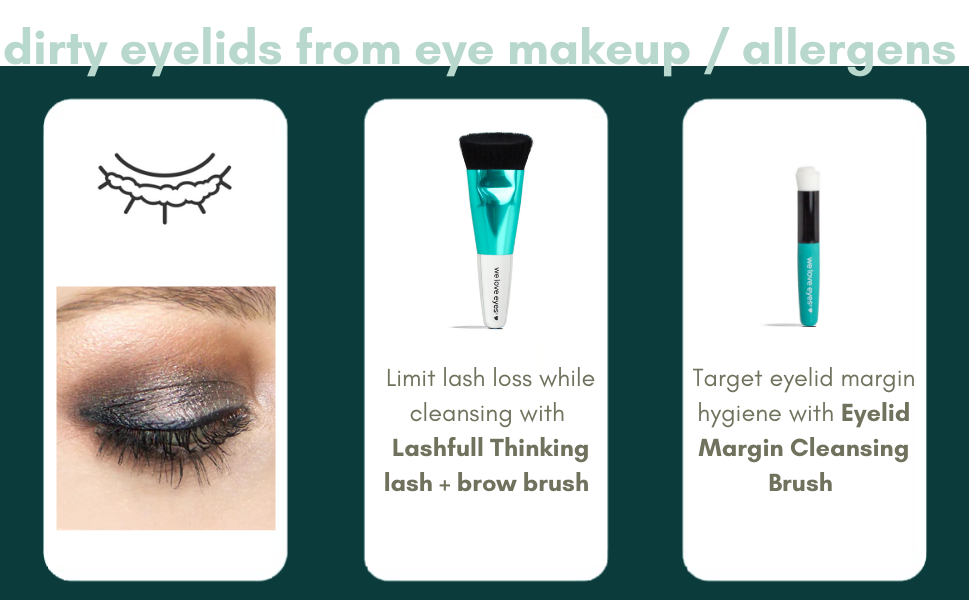 Find your eyelid margin debris - from eye makeup and allergens