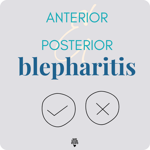 BLEPHARITIS ANTERIOR BLEPHARITIS POSTERIOR BLEPHARITIS We Love Eyes BLEPHARITIS guide
