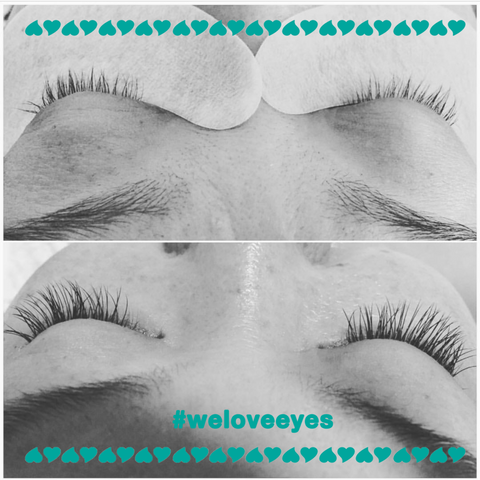 blepharitis optometrist safer