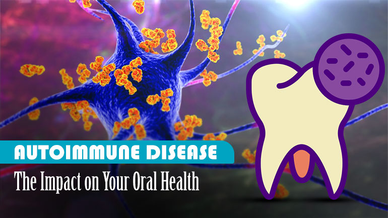 Autoimmune Disease The Impact on Your Oral Health