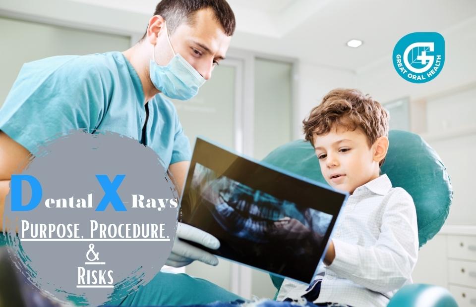 Dental X-Rays Purpose, Procedure, and Risks