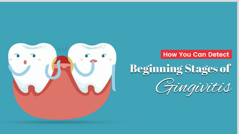 How You Can Detect Beginning Stages Of Gingivitis