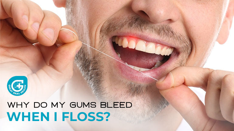 Why Do My Gums Bleed When I Floss? Let's Find out Today
