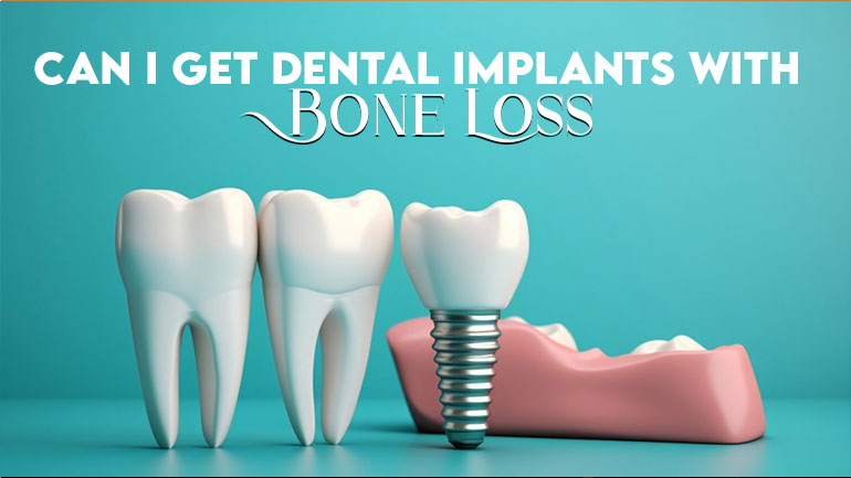 Can I Get Dental Implants with Bone Loss.