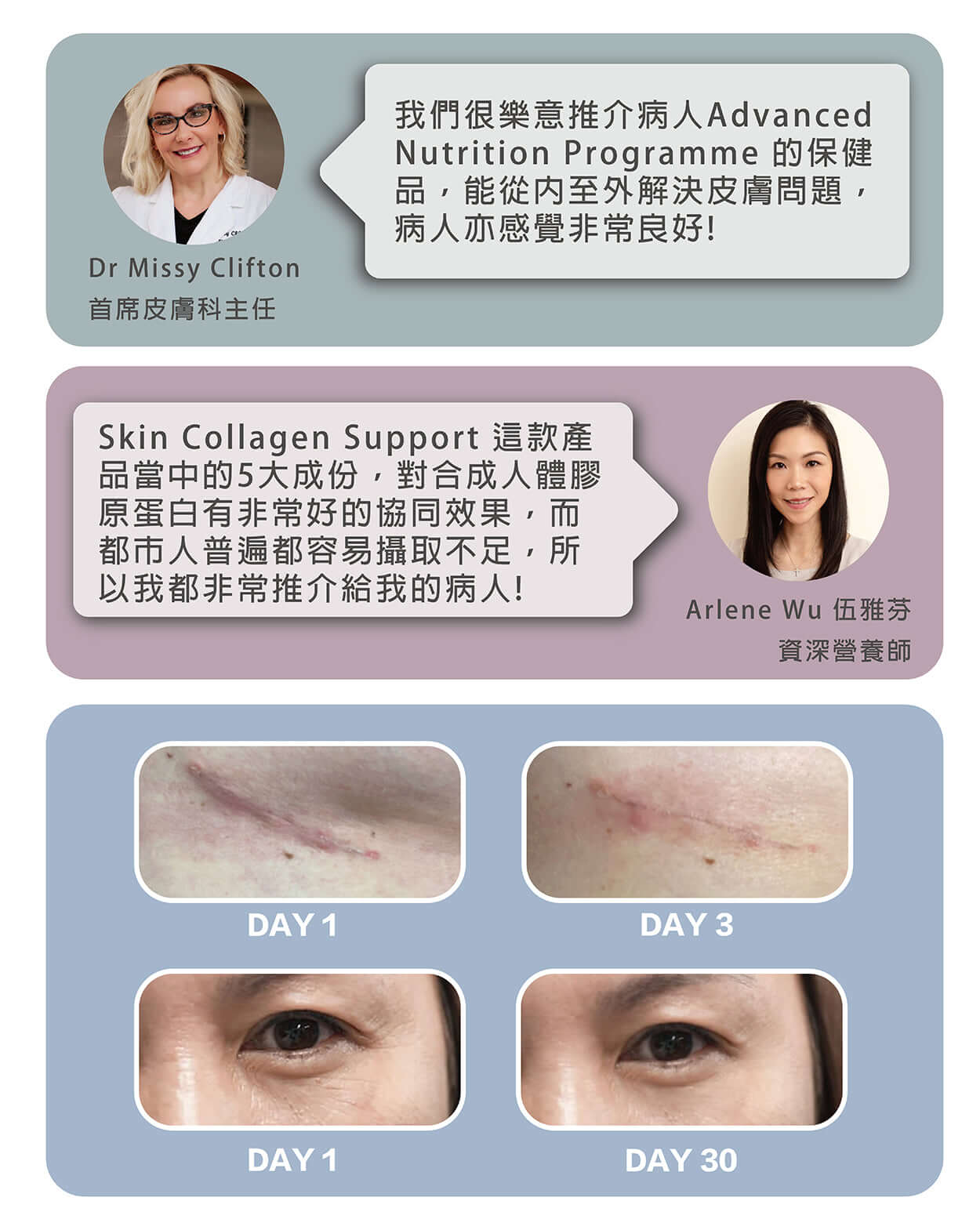 ANP 激活膠原回彈療程 Skin Collagen Support product description 3