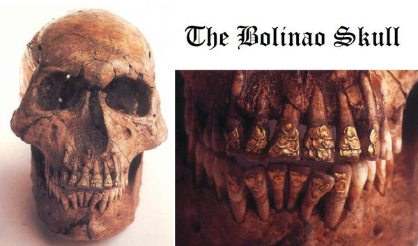 The Bolinao Skull, considered to be a monumental discovery due to its gold dental decorations that resemble fish scales. (Photo from IFY Books)