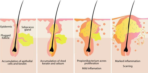 hair cross section