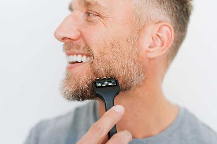 Man smiling using derma roller on his beard