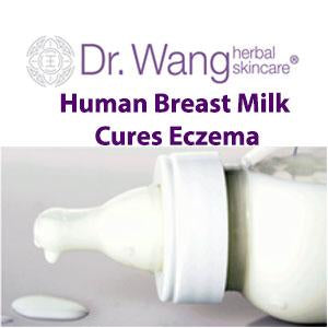 breast milk lotion for eczema