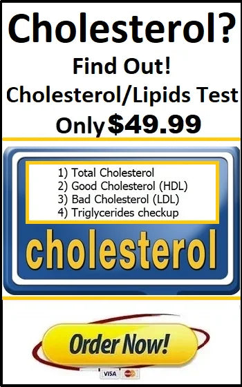 Cholesterol Test 49.99