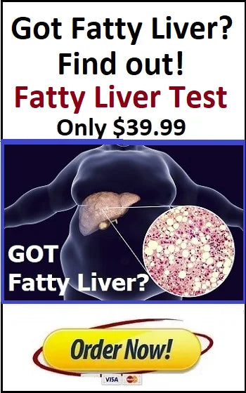 Fatty Liver Lab Test