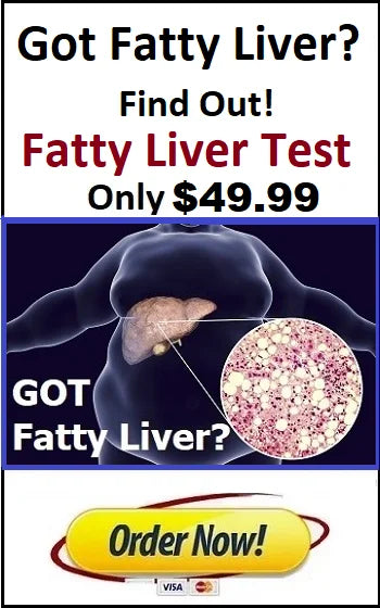 Fatty Liver Test 49.99