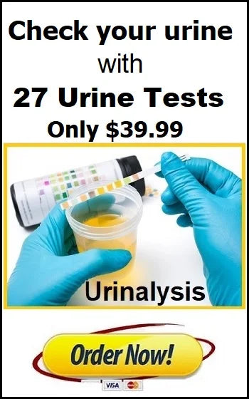 Urinalysis Urine Test