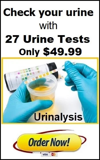 Labs Urine Test 49.99