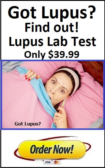 Lupus Lab Test